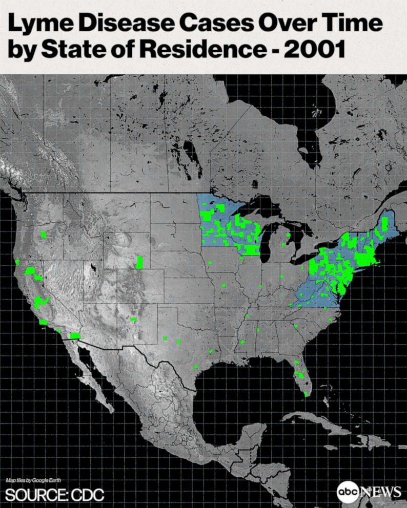 PHOTO: Lyme Disease Cases Over Time by State of Residence - 2001
