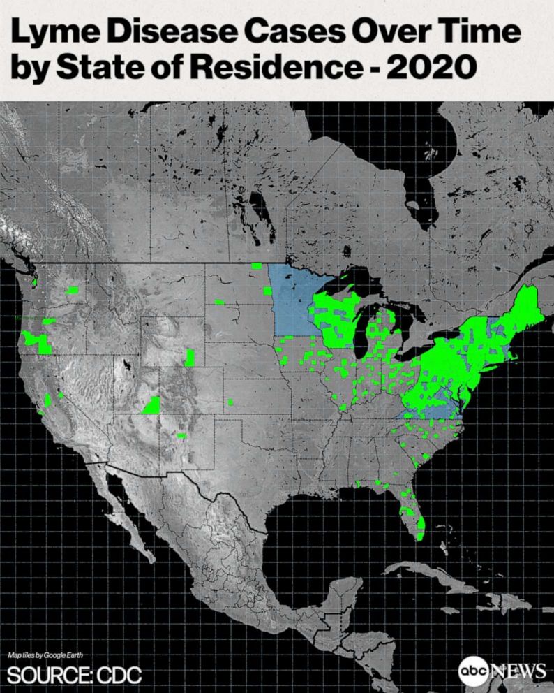 PHOTO: Lyme Disease Cases Over Time by State of Residence - 2020