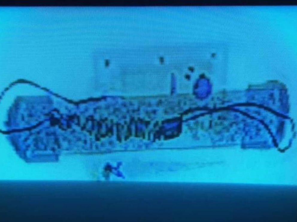 PHOTO: An x-ray of the explosive device recovered at Time Warner Center in New York on Oct. 24, 2018.
