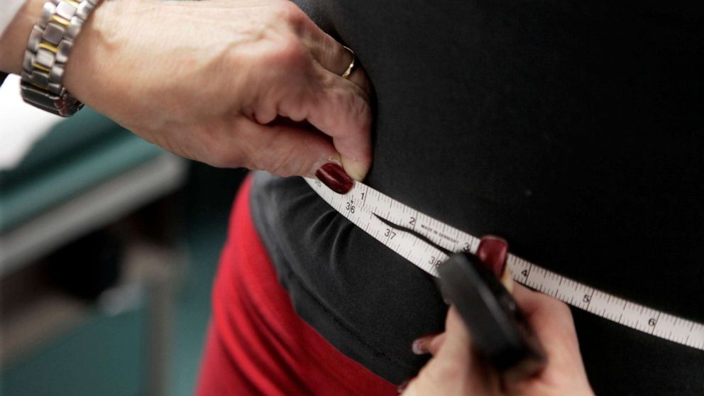 PHOTO: In this Jan. 20, 2010 file photo, a subject's waist is measured during an obesity prevention study in Chicago. According to a Centers for Disease Control and Prevention study released on Thursday, Feb. 27, 2020.