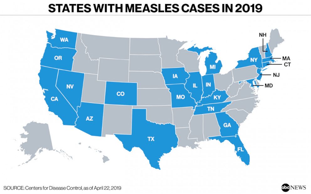 PHOTO: States with measles cases in 2019