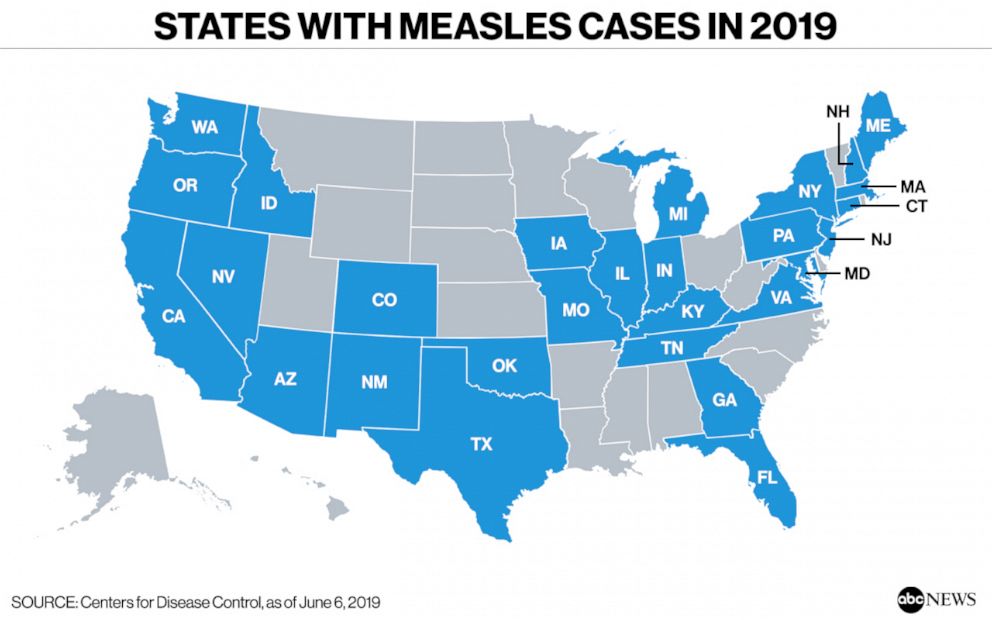 PHOTO: States with Measles Cases in 2019