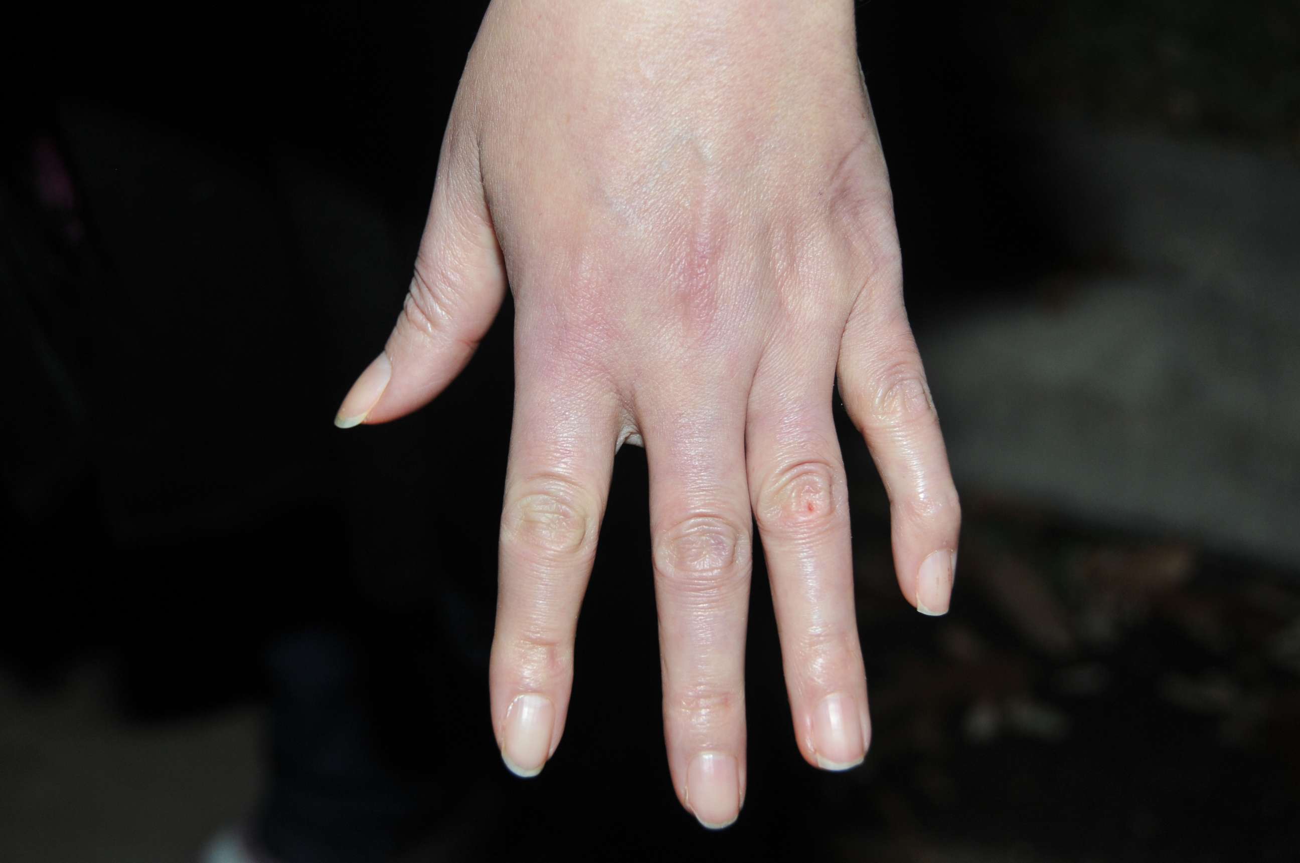 PHOTO: Sandra Melgar's hands were a subject of debate -- if she was guilty, why were her hands clean from blood and her nails undamaged from the violence?