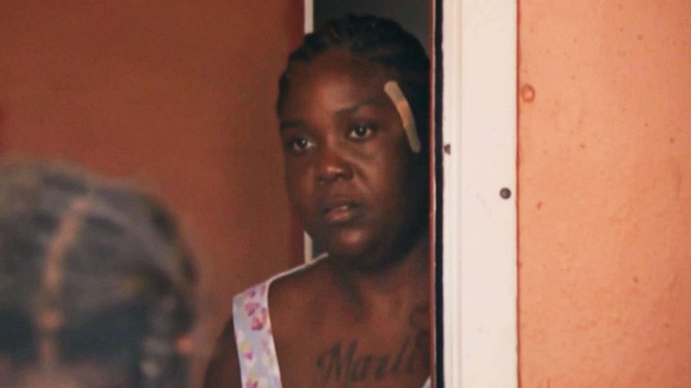 PHOTO: Shakena Jefferson, victim of drive-by shooting on Feb. 11, 2020, in Miami, is seen at her home after being discharged from a hospital.