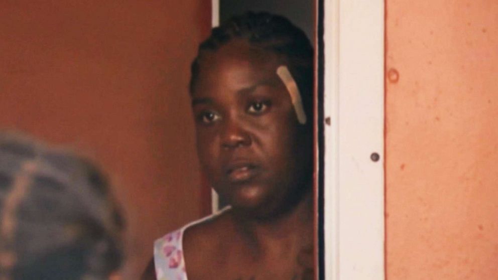 PHOTO: Shakena Jefferson, victim of drive-by shooting on Feb. 11, 2020, in Miami, is seen at her home after being discharged from a hospital.