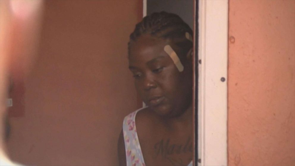 PHOTO: Shakena Jefferson, victim of drive-by shooting on Feb. 11, 2020, in Miami, is seen at her home after being discharged from a hospital what doctors initially told her was a graze wound. 