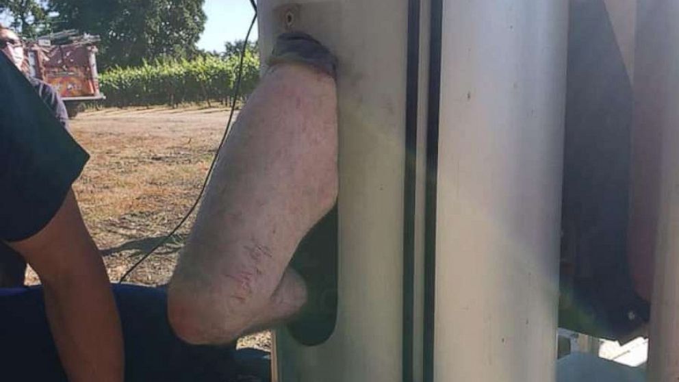 PHOTO: A man is lucky to be alive after he was rescued from being stuck for two days inside farm equipment at a vineyard in Santa Rosa, California, after Sonoma Sheriff’s Office received a complaint of a suspicious vehicle on June 8, 2021. 
