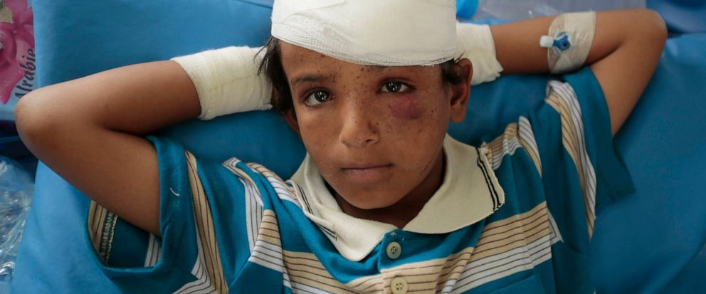 FILE - In this Aug. 12, 2018, file, photo, A child injured in a deadly Saudi-led coalition airstrike on Thursday rests in a hospital in Saada, Yemen. A database tracking violence said Wednesday, June 19, 2019 that at least 91,600 people have been kil