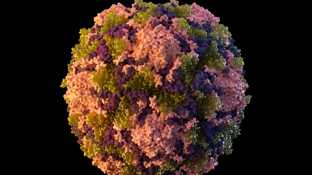 This 2014 illustration made available by the U.S. Centers for Disease Control and Prevention depicts a polio virus particle. On Thursday, July 21, 2022, New York health officials reported a polio case, the first in the U.S. in nearly a decade. (Sarah