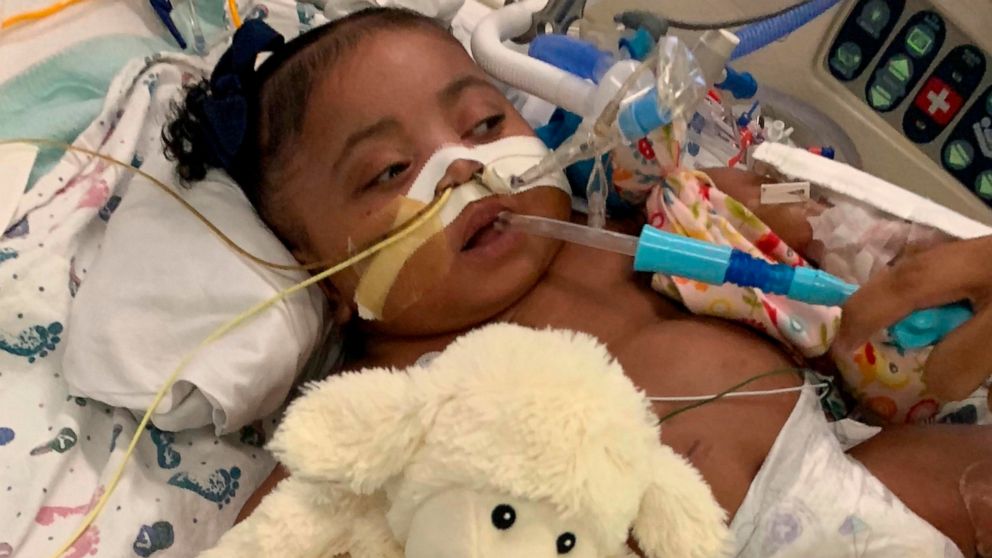 This undated photo provided by Texas Right to Life shows Tinslee Lewis. After a hospital's plans to remove the 9-month-old girl from a ventilator against her family's wishes were halted, a spotlight is once again on the Texas law that gives families 