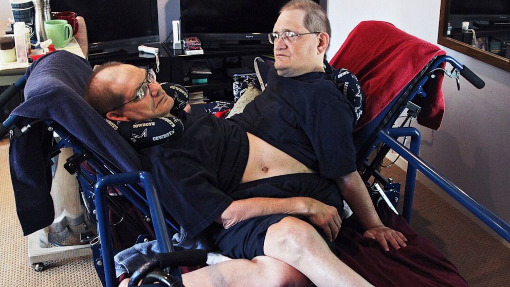 FILE - Donnie, left, and Ronnie Galyon sit inside their Beavercreek, Ohio, home, in a Wednesday, July 2, 2014 file photo. The world’s longest surviving conjoined twins died on July 4, 2020 at the age of 68. Ronnie and Donnie Galyon of Beavercreek, Oh