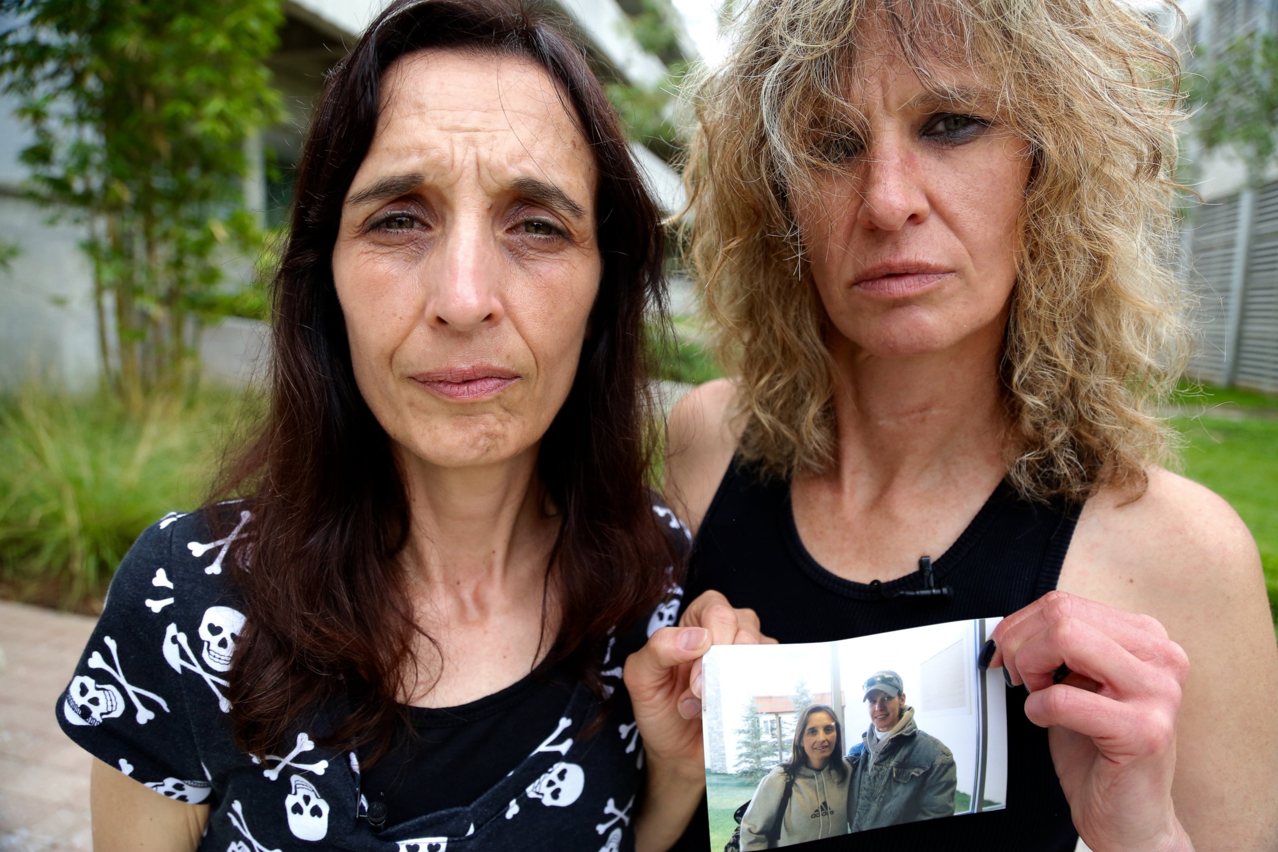 Leigh Erceg, right, and her friend Amber Anastasio, left, are shown here holding a picture of the two of them taken before Erceg's accident.