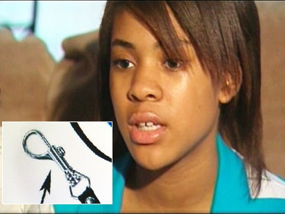 Video: Recalled dog leash injuries girl.