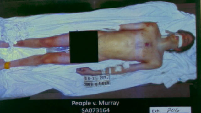 PHOTO: A photo of Michael Jackson post mortem is shown, after being presented as evidence during the Conrad Murray trial, Oct. 11, 2011.