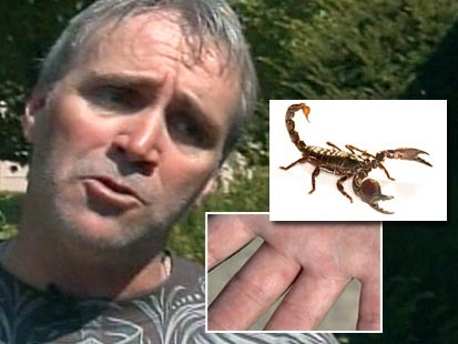 Video: Plane stung by scorpion on plane.