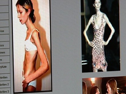 Pro-Anorexia Sites Deadly Messages