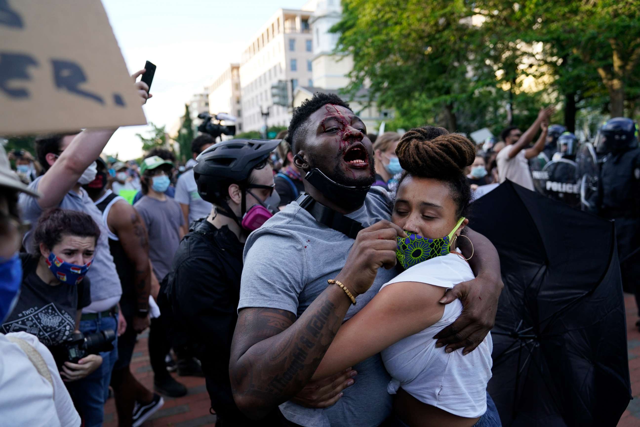 PHOTO: Abimbola George bleeds from an injury that he sustained near the White House during a demonstration over the the death of George Floyd, May 30, 2020, in Washington.