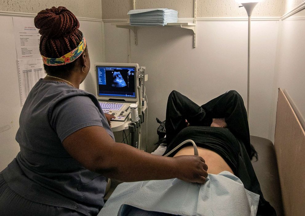 PHOTO: An operating room technician performs an ultrasound on a patient at Hope Medical Group for Women in Shreveport, La., on July 6, 2022.