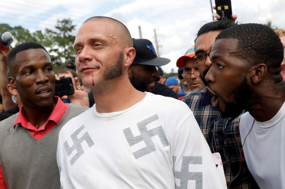 PHOTO: A man walks with a bloody lip outside the location where Richard Spencer, an avowed white nationalist and spokesperson for the so-called alt-right movement, is delivering a speech in Gainesville, Fla, Oct. 19, 2017.