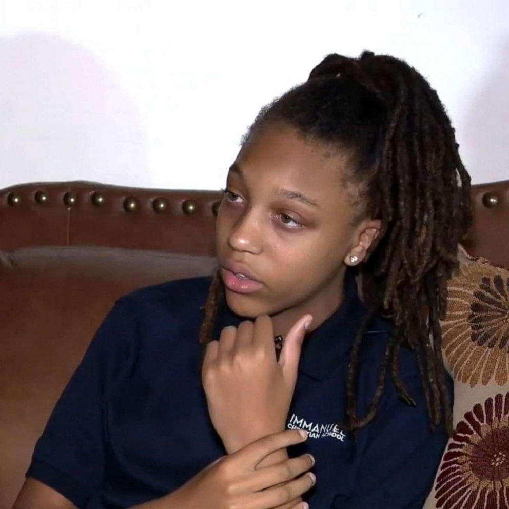 White students allegedly pin down black girl, forcefully cut her 'nappy'  dreadlocks - ABC News