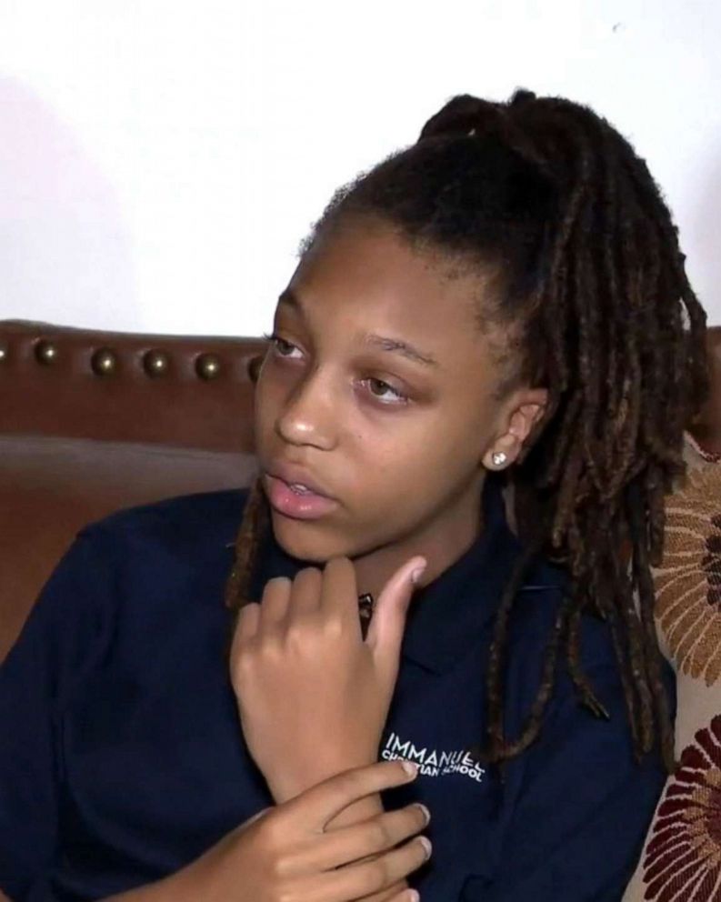 White Students Allegedly Pin Down Black Girl Forcefully Cut Her Nappy Dreadlocks Abc News