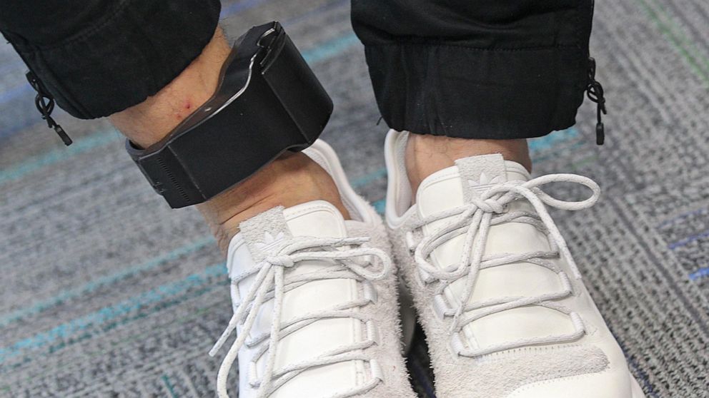 PHOTO: A government ankle monitor.