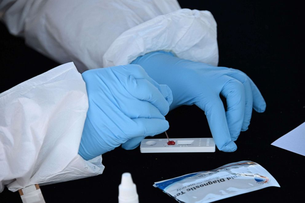 PHOTO: A blood sample is tested at a coronavirus antibody rapid serological testing site on on July 26, 2020 in San Dimas, California.