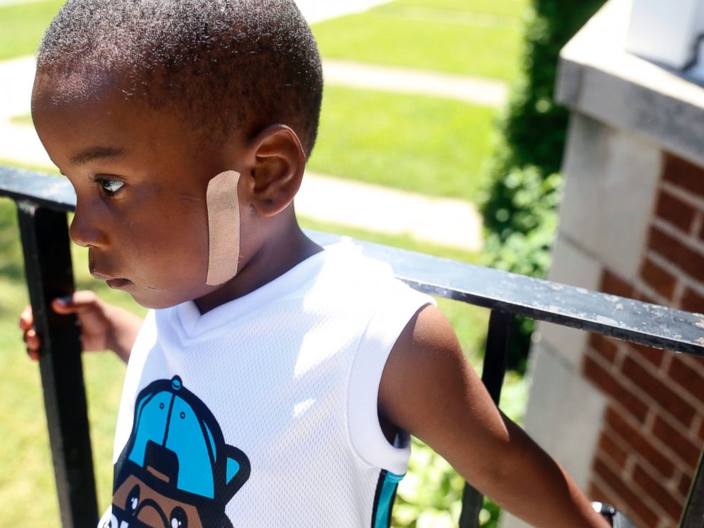 PHOTO: Kavan Collins, 4, stands on his fathers porch in Chicago on July 19, 2016.