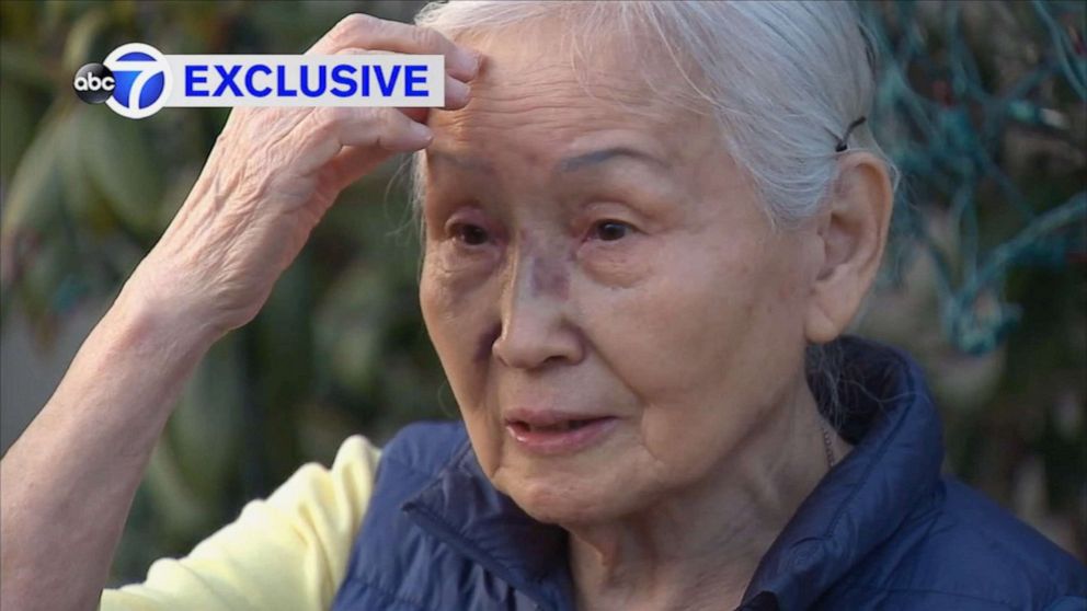 PHOTO: Nancy Toh, 83, talks about being attacked on the evening of March 9, 2021, in White Plains, N.Y., by a person who spit in her face and then knocked her to the ground. 