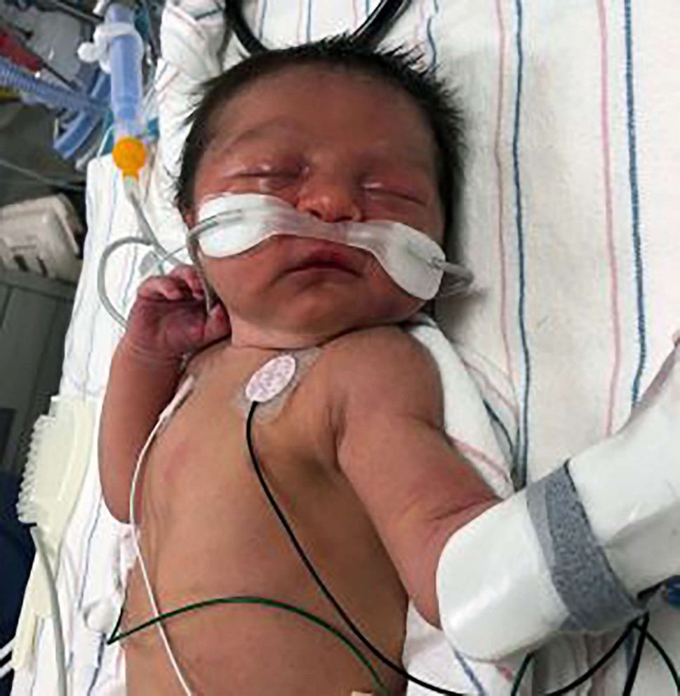 PHOTO: A newborn baby was found in a wooded area in Silver Spring, Md., Aug. 16, 2019. 