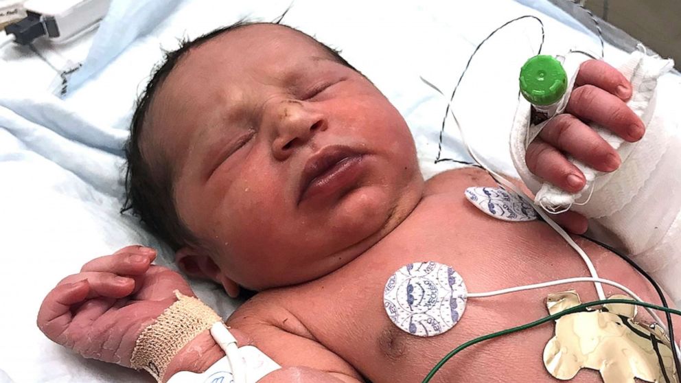 PHOTO: This photo released by the Forsyth County Sheriff's Office shows a newborn baby girl found alive in a plastic bag in a wooded area in Cumming, Ga., by Forsyth County deputies Thursday, June 6, 2019.