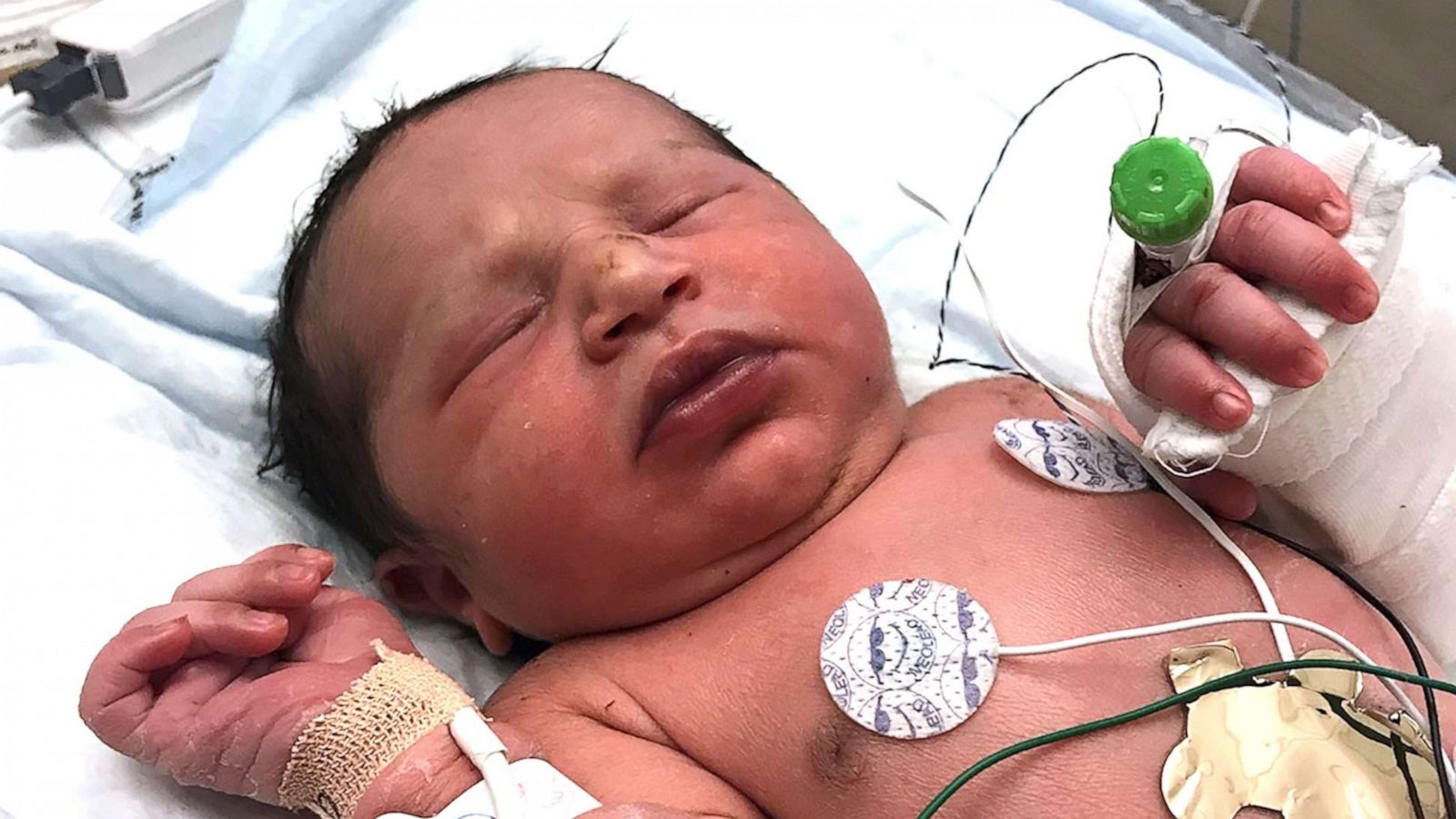 PHOTO: This photo released by the Forsyth County Sheriff's Office shows a newborn baby girl found alive in a plastic bag in a wooded area in Cumming, Ga., by Forsyth County deputies Thursday, June 6, 2019.