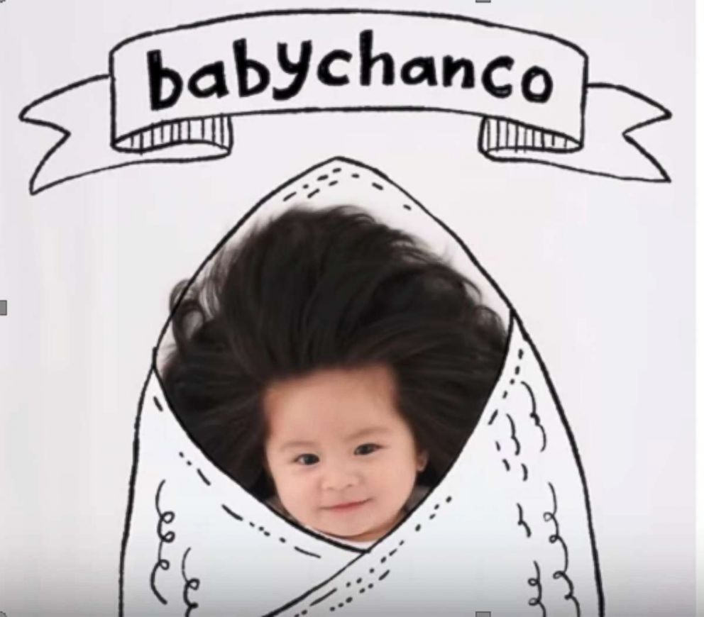 PHOTO: Baby Chanco was recently named the face of Pantene in Japan.
