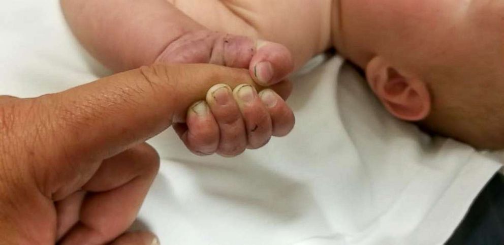 PHOTO: A 5-month-old baby was rescued in Montana after being left partially buried on a mountain, the Missoula Count sheriff’s office said.