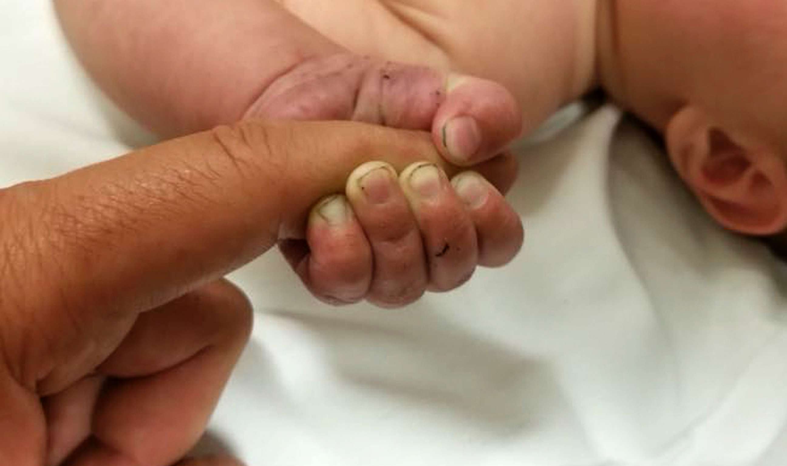 PHOTO: A 5-month-old baby survived after being buried under a pile of sticks in the woods for at least nine hours, Montana authorities said. 