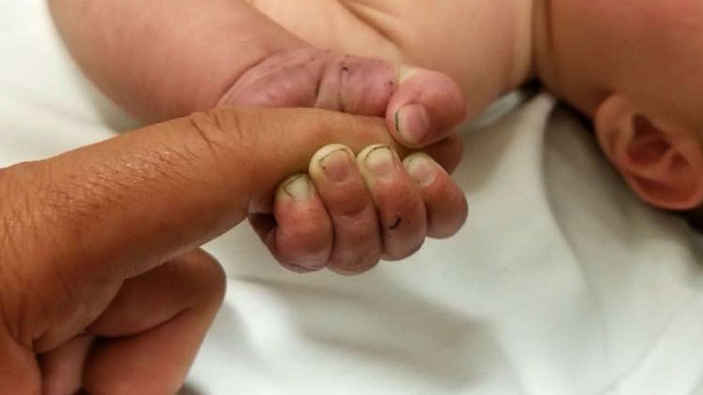 PHOTO: A 5-month-old baby survived after being buried under a pile of sticks in the woods for at least nine hours, Montana authorities said. 