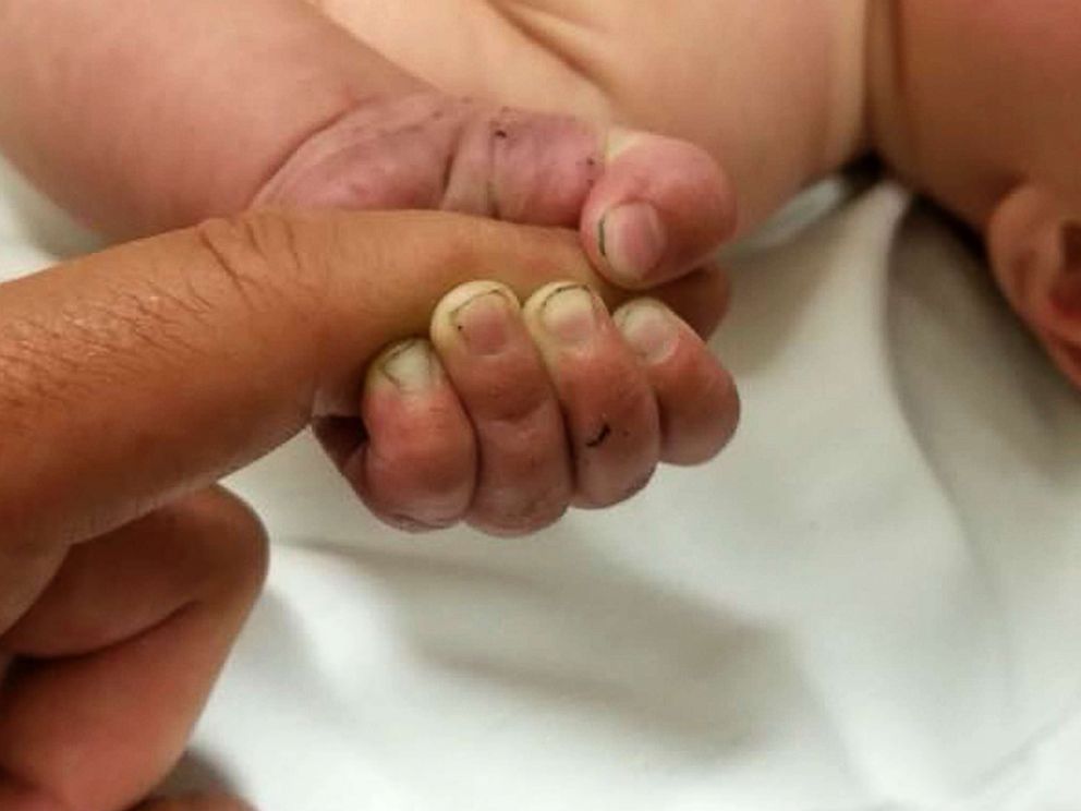 PHOTO: A 5-month-old baby survived after being buried under a pile of sticks in the woods for at least nine hours, Montana authorities said.