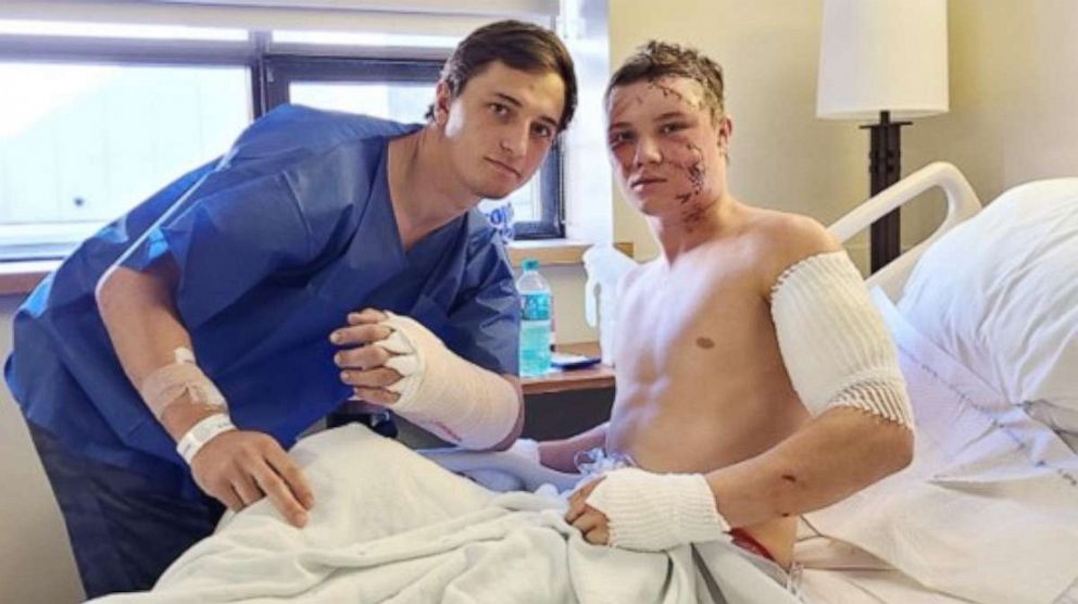 PHOTO: Brady Lowry (left) and Kendell Cummings (right) were injured in a grizzly bear attack in Cody, Wyoming.