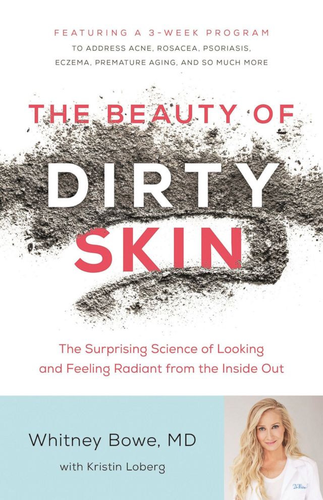 PHOTO: Dermatologist Dr. Whitney Bowe is out with a new book "The Beauty of Dirty Skin" which features some of her top skincare tips. 
