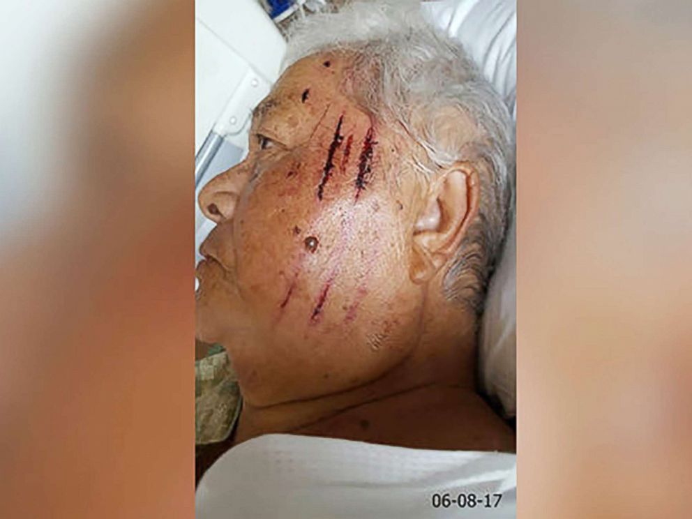 PHOTO: Bernice Kakona suffered head, chest and leg wounds following a fall at Portland International Airport.