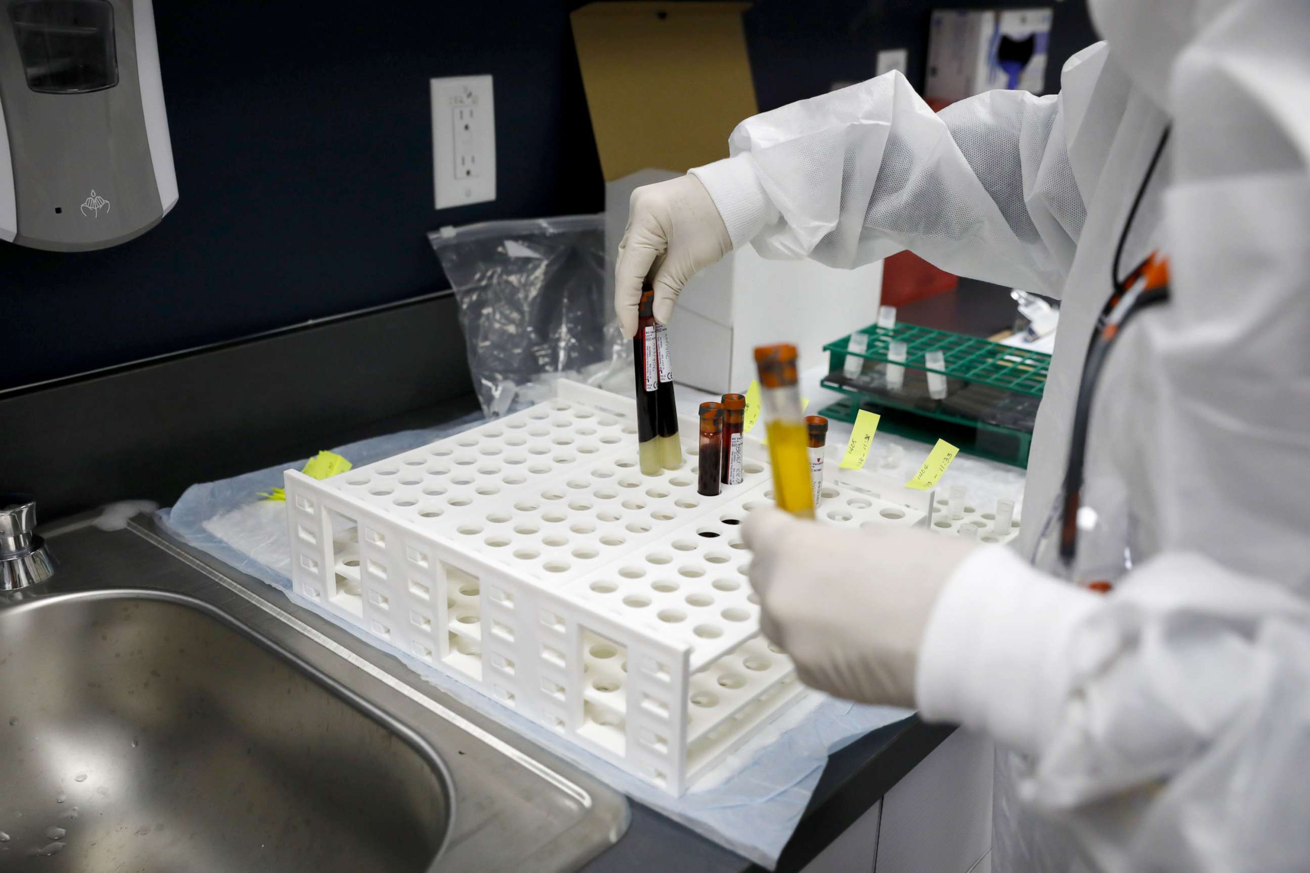 PHOTO: A health worker holds blood samples during clinical trials for a Covid-19 vaccine at Research Centers of America in Hollywood, Fla., Sept. 9, 2020.