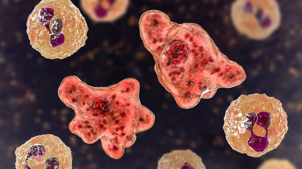 Disaster declaration issued for Texas county after brain-eating amoeba  found in water supply - ABC News