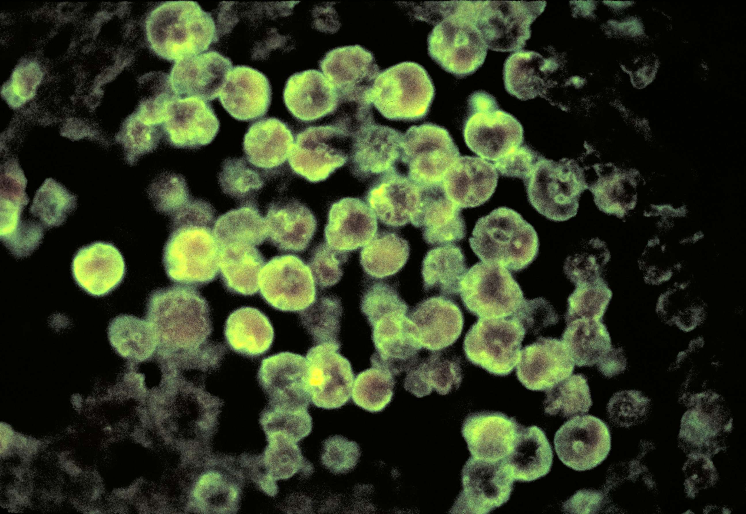 PHOTO: Using the direct fluorescent antibody (DFA) staining technique, this photomicrograph depicts the histopathologic characteristics associated with a case of amebic meningoencephalitis due to Naegleria fowleri parasites.