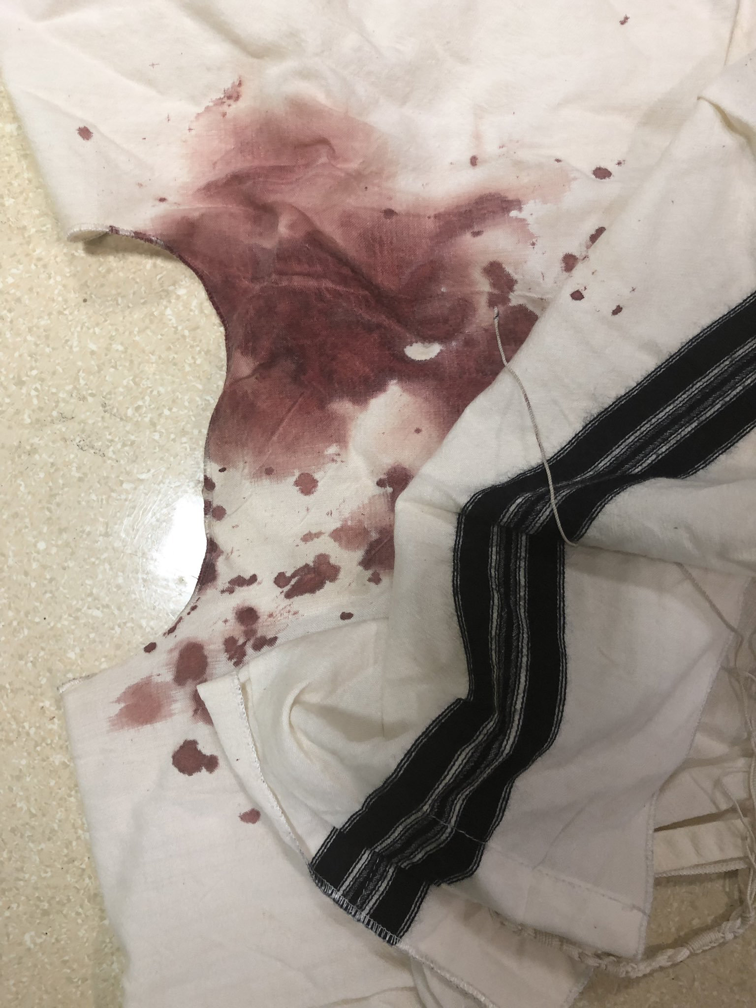 PHOTO: This photo of a bloodstained religious garment was posted to social media by Benny Friedman after his father-in-law, a Hasidic Jew, was attacked in the Brooklyn borough of New York, on Aug. 27, 2019.