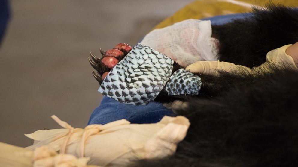 PHOTO: A young, female bear with paws badly burned in the Carr Fire is rescued by the California Department of Fish and Wildlife, and is treated with fish skin.