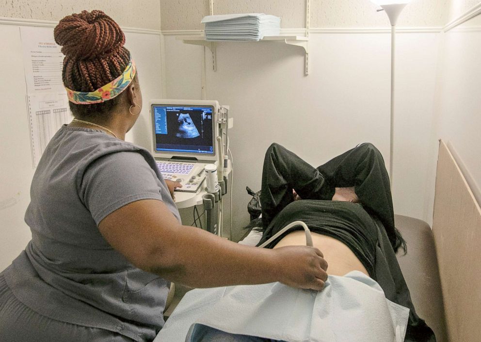PHOTO: An operating room technician performs an ultrasound on a patient at Hope Medical Group for Women in Shreveport, La., July 6, 2022.