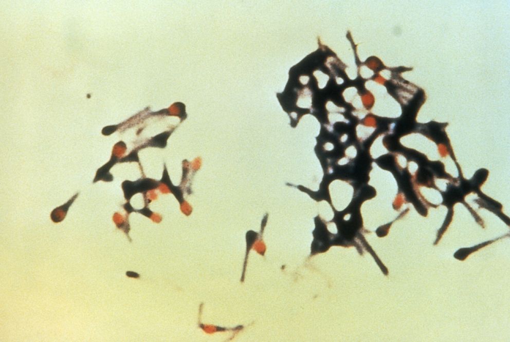 PHOTO: An image taken in 1995 and released by the Centers for Disease Control shows a group of Clostridium tetani bacteria, responsible for causing tetanus in humans.