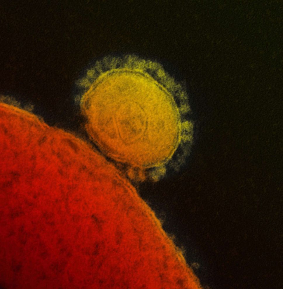 PHOTO: Coronavirus.