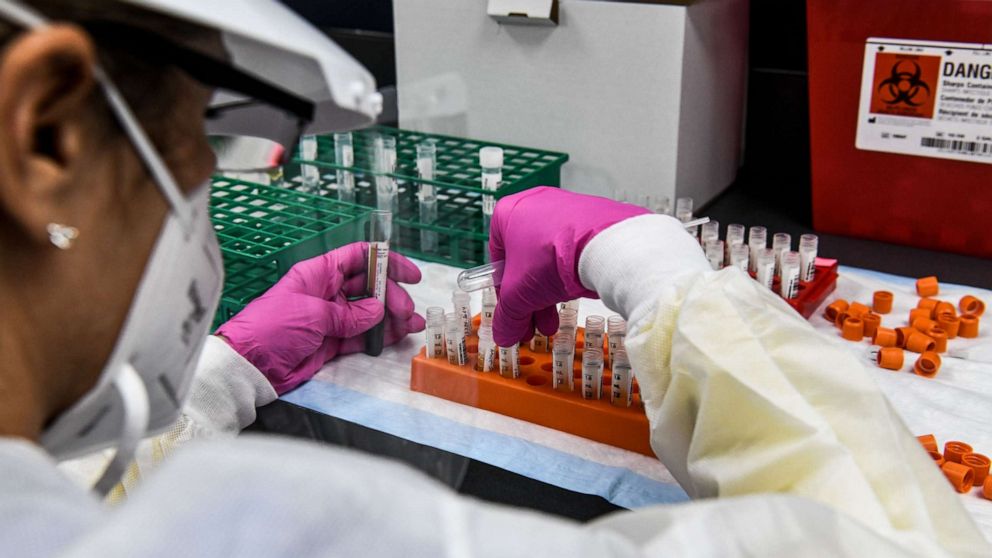 PHOTO: In this file photo taken on August 13, 2020, a lab technician sorts blood samples inside a lab for a Covid-19 vaccine study at the Research Centers of America (RCA) in Hollywood, Florida. 