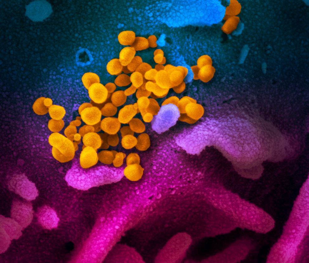 PHOTO: This handout illustration image taken with a scanning electron microscope shows SARS-CoV-2 (yellow)also known as 2019-nCoV, the virus that causes COVID-19isolated emerging from the surface of cells (blue/pink) cultured in the lab.